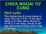 Chửa ngoài tử cung