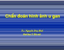 Chẩn đoán hình ảnh u gan