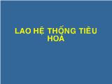 Lao hệ thống tiêu hoá