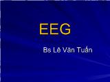 Tìm hiểu Eeg