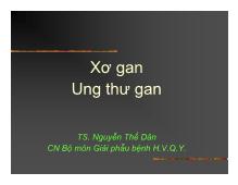 Xơ gan Ung thư gan