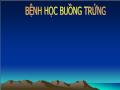 Bệnh học buồng trứng