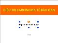 Điều trị carcinoma tế bào gan