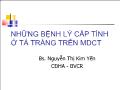 Những bệnh lý cấp tính ở tá tràng trên MDCT