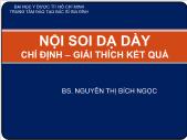 Nội soi dạ dày: chỉ định – giải thích kết quả