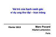 Vai trò của hạch canh gác ví dụ ung thư đại – trực tràng