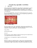 Viêm nướu răng - Nguyên nhân và cách điều trị