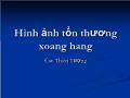 Hình ảnh tổn thương xoang hang