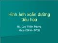 Hình ảnh xoắn đường tiêu hoá